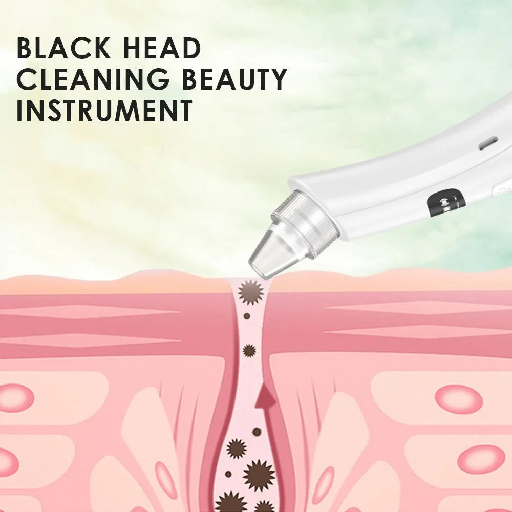 PoreVac – 3 Mode Blackhead Removal Vacuum Cleanser