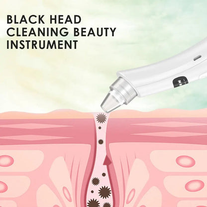 PoreVac – 3 Mode Blackhead Removal Vacuum Cleanser