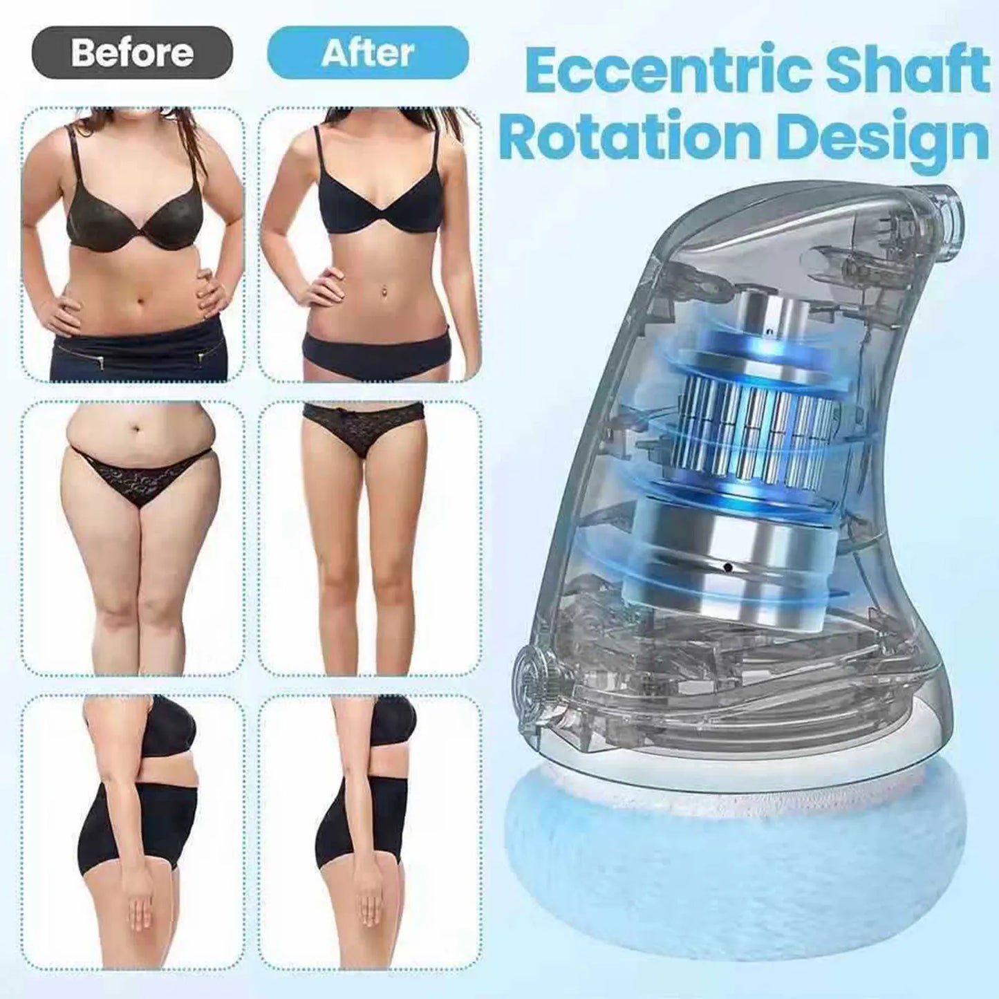 BodySculpt – Electric Cellulite Massager with Reusable Pads